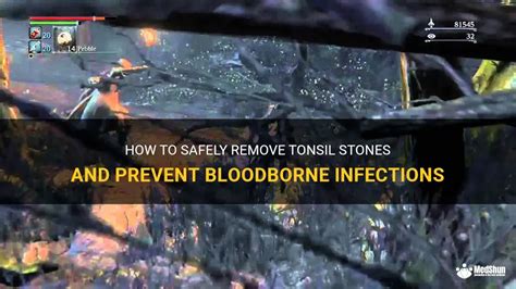 how to get tonsil stone bloodborne|Tonsil Stone